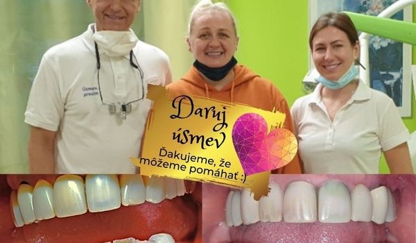 Iniciatíva Daruj úsmev - premena pacientky Ivetky